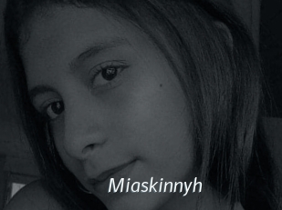 Miaskinnyh