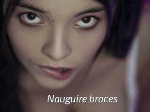 Nauguire_braces